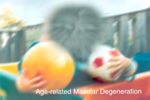 vision-with-age-related-macular-degeneration